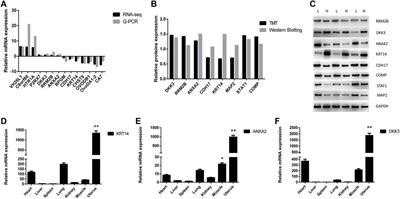 Multiomic analysis revealed the regulatory role of the KRT14 gene in eggshell quality